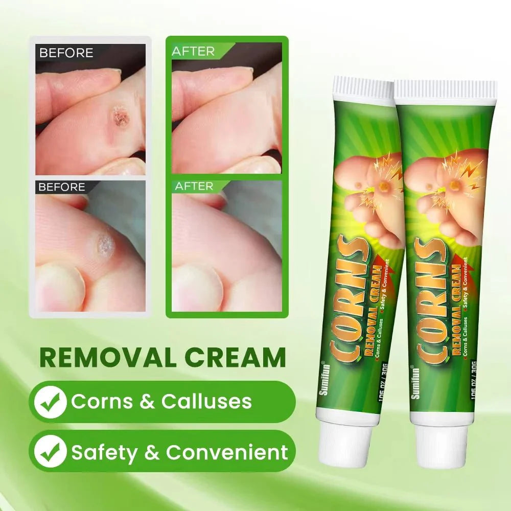 Sumifun - Corns Removal Cream (Original)