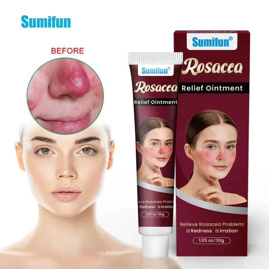 Sumifun - Rosacca Relief Ointment (Original)