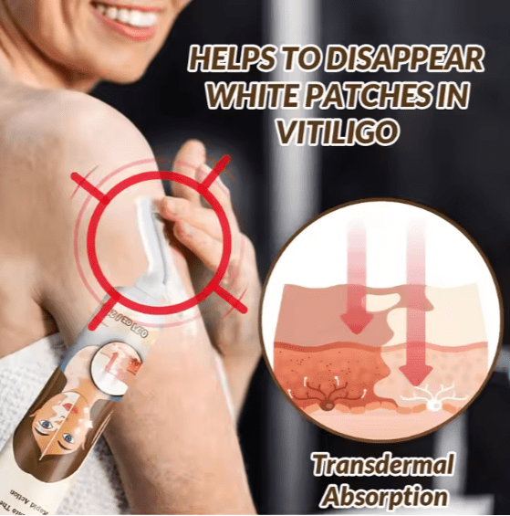 Sumifun - Vitiligo Removal Cream (Original)