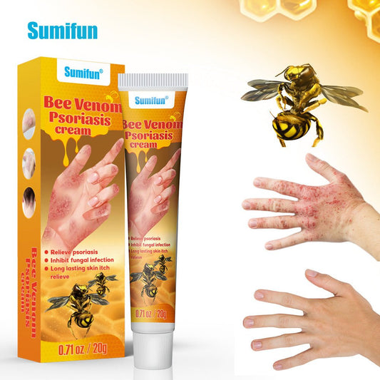Summifun - Bee Venom Psoriasis Cream (Original)