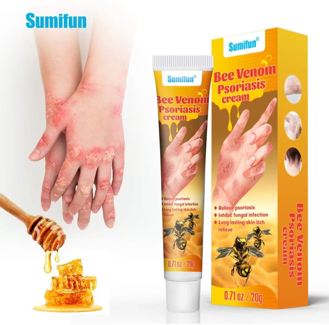 Summifun - Bee Venom Psoriasis Cream (Original)