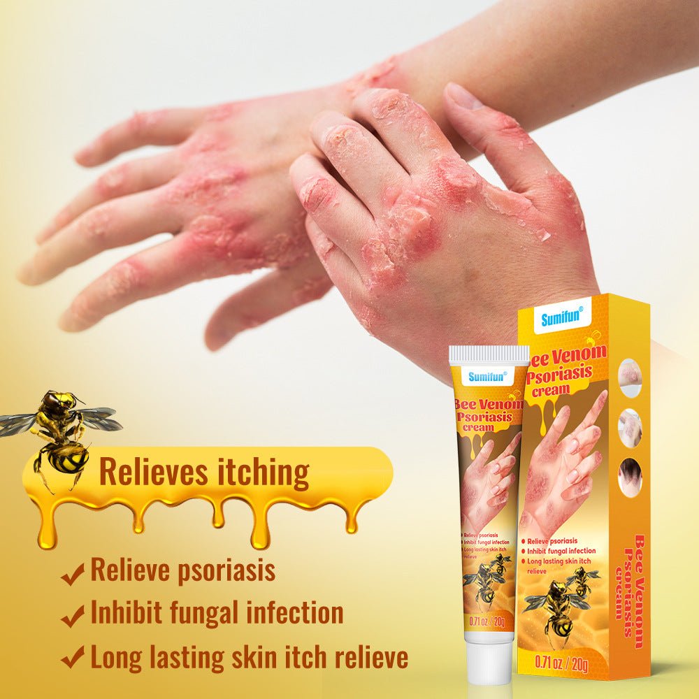 Summifun - Bee Venom Psoriasis Cream (Original)